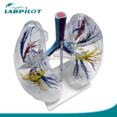 China Deployment of Trachea and Bronchial Tree Segment Transparent Lung Model, Lung Model with Trachea and Bronchial Tree for sale