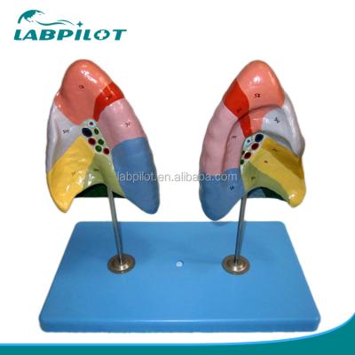 China High Quality Advanced Painting Lung Model Bronchopulmonary Segments Lung Model, Pulmonary Segments Lung Model for sale