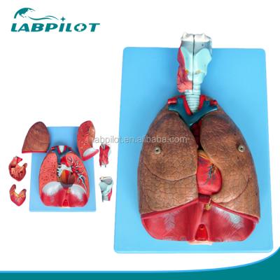 China Detailed Anatomy Structures Medical Biological 3D Larynx Trachea Heart And Lung Model for sale