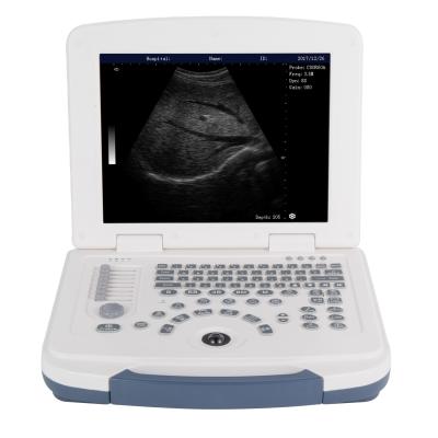 China Abdomen RC-BW580 the basic black and white portable ultrasound scanner machine for sale for sale