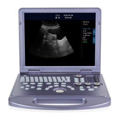 China RC-BW360 2d abdomen portable laptop ultrasound scanner machine black and white system for sale