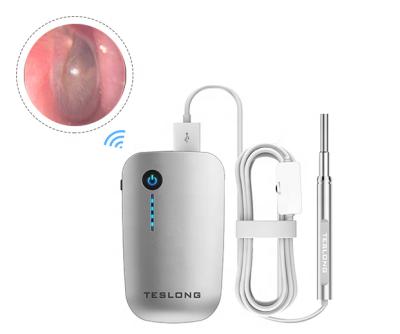 China Teslong 4.3mm Inspection Home Personal Video Care Radio Otoscope 1280 x 720 Pixels Digital Earwax Removal Tools for sale