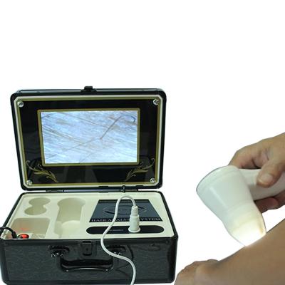 China Skin wrinkle analysis 9 inch portable skin analyzer magic mirror skin analyzer machine for sale