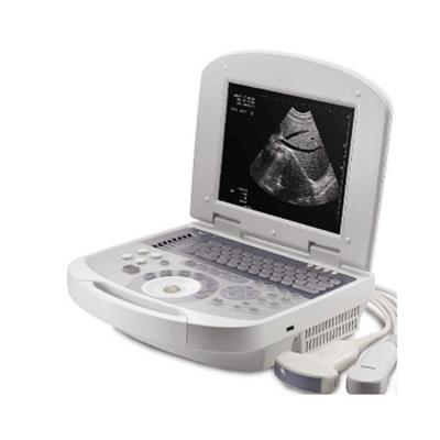 China High quality CE certificate portable a scan for ophthalmology Medical ultrasound equipment for sale