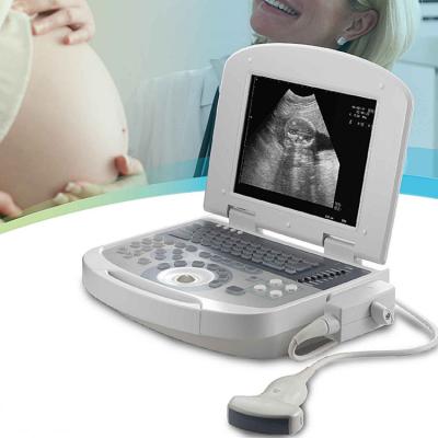 China Factory Direct ultrasound machine 4d cardiac ultrasound probe medical ultrasound instruments for sale