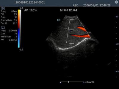 China Tragbare Ultraschall-Scanner-Farb-Doppler-Maschine mit 15 Zoll LCD-Monitor zu verkaufen