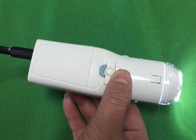 China Elektronischer Colposcope vaginale Kamera-Digital, zum von Krankheit des Halses Eealier zu finden zu verkaufen