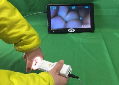 China X Colposcope electrónico de 1,5 Digitaces de la ampliación conecta con la TV u ordenador o monitor médico para salud de s de las mujeres ' en venta