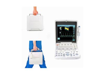 China Tragbarer Farb-Doppler-Ultraschall-Scanner mit 12,1-Zoll-Bildschirm 2.5-10-MHZ-Mehrfrequenzsonde zu verkaufen