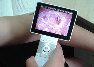 China Hand- Haut-und Haar-Analyse Video-Dermatoscope mit 3,5 Zoll bunter LCD zu verkaufen