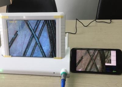 China Digital-Vergrößerungsglas Hand- Video-Dermatoscope-Haut-Analysator mit Daten-Bericht des Öl-Feuchtigkeits-Pigments flexibel zu verkaufen