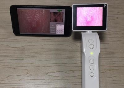 Κίνα Φορητή ψηφιακή τηλεοπτική Dermatoscope Wifi σύνδεση Dermatoscope στο κινητό τηλέφωνο οθόνη 3,5 ίντσας προς πώληση