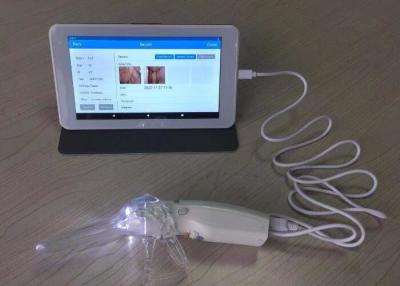 China Digitale Videocolposcope voor Vrouwenzorg Professionele Camera van de 10 of 7 Duim de Medische Monitor voor Inspectie van Cervix Te koop