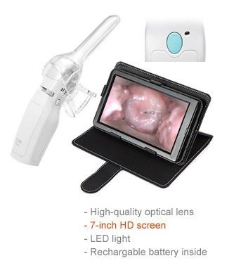 China De vaginale Camera voor Vrouwen geeft Digitale Minicolposcope 1,5 Keer Vergroting 10cm Observatieafstand Te koop