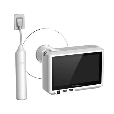 China Digital Sensor Dental Equipment High Performance Acrylic Portable Dental X-ray Machine for sale