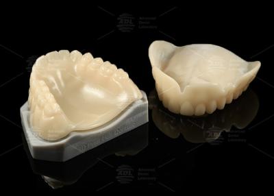 Chine Prothèses dentaires imprimées en 3D Essayez en bio compatible A1/A2/A3 Parfait ajustement et occlusion à vendre