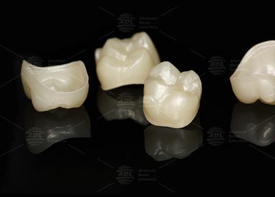 China Natural Full Contour Zirconia Crown Precise Fit Full Contour Dental Lab for sale