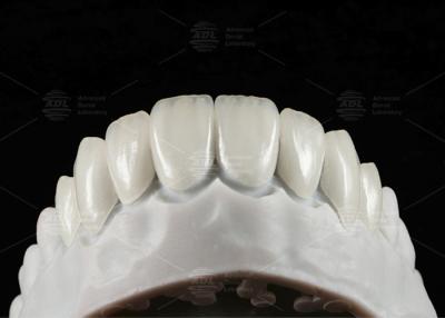 Chine Faisceau de dentition EMAX pressé naturel 16 nuances à vendre