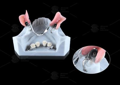 China 0.1mm Tolerantie CEKA REVAX Aanhangsel Titanium 3mm Verticale vrijheid Te koop