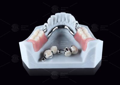 China CEKA M2 Präzisionsbefestigung Titan mit 3 mm horizontalen / vertikalen Abstand zu verkaufen