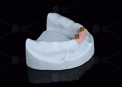 Chine Localisateur en titane, accessoires dentaires pour les surdentures en argent et en or à vendre