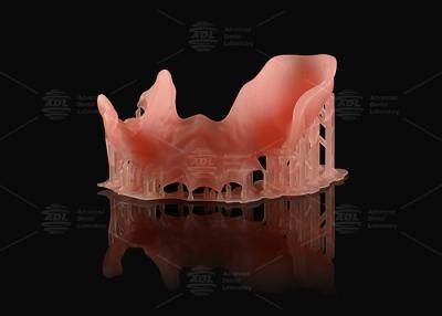 Chine Prothèse partielle en acrylique rose orange Dentures numériques d'apparence naturelle d'impression 3D à vendre