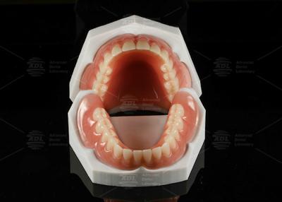 China Alta estética Dentadura removible de acrílico completo Dentadura completa de acrílico en venta