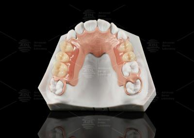 China Weiß und Rosa Peek Flexible Acryl-Teilprothese mit hervorragender Beständigkeit zu verkaufen