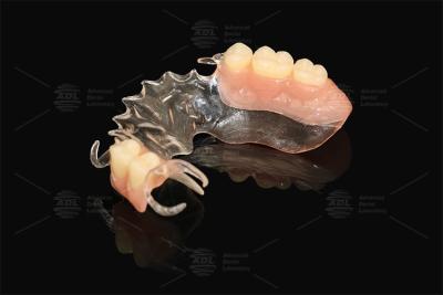 China Vertex Clear  Flexible Partial Virtually Unbreakable Low Allergy Risk Full Partial Denture for sale