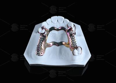 Chine Peau sensible cadre en titane haute résistance solution imprimée 3D à vendre