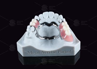 China Removable Metal Acrylic Partial Denture With Clasps For Partial Chewing for sale