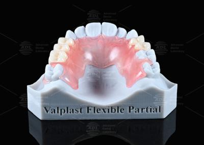 China Apariencia natural Valplast Dentadura parcial Durabilidad muy resistente a las fracturas en venta