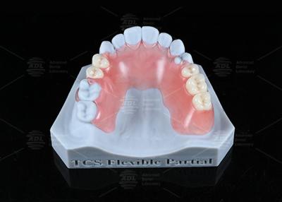 China TCS Flexible Partial Stain Resistant BPA Free Partial Dentures For Natural Look for sale