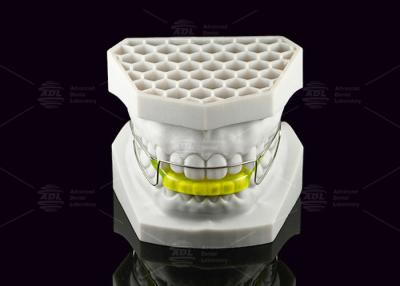 China Acryl orthodontische bionator apparaat corrigeert Klasse II Malocclusie Te koop