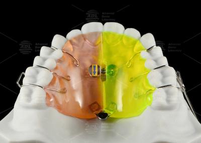 China Orthodontische Ventilator-förmige Expanse ermöglicht eine nachträgliche, durchbohrungsfreie Expansion des Abschnitts zu verkaufen