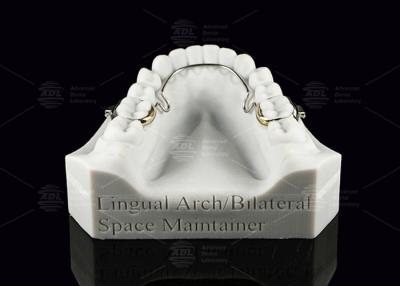 China Arco Lingual Mantenedor de espacio bilateral Dientes de acero inoxidable Mantenedores de espacio en venta