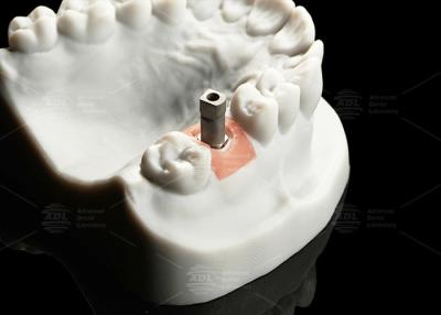 China Präzisions-Titanium-Digitalimplantat-Scanner Körper Sandblasted Oberfläche für Cad/Cam zu verkaufen