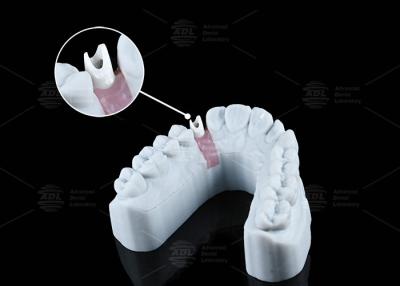 China Wit Custom Zirconia Abutment Natuurlijk uitziende esthetiek en optimale functionaliteit Te koop