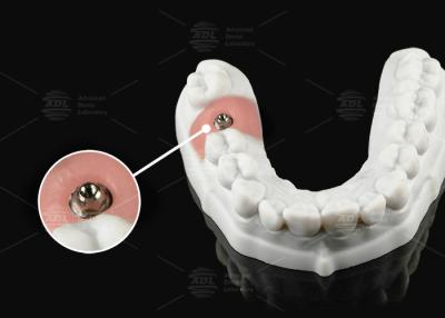 China Abutment multiunidade de titânio de prata-ouro para plataforma protética de unidade única ou múltipla à venda