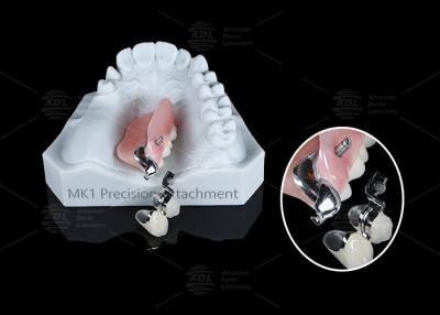 China MK1 Precision Attachment Afneembare gedeeltelijke tandheelkunde Gemakkelijke installatie Te koop