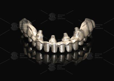 China Hybride rosa Porzellan Implantat Krone Malong Vollbogen Implantat Brücke Sofortiges Laden zu verkaufen