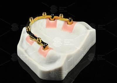 China Barras de localizador de implantes dentários de titânio em areia de prata de ouro à venda