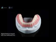 Orange Pink Acrylic Partial Denture Natural Looking 3d Printing Digital Dentures