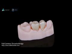 High Translucency Full Contour Zirconia Bridge Chipping Resistance Natural Esthetics