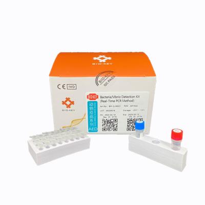 Cina Corredo diagnostico in tempo reale batterico di PCR del laboratorio medico di rilevazione del vibrione di acquacoltura in vendita