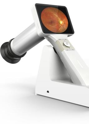 China Hochauflösende Handfundus-Kamera 2.5mm für Fundus-Krankheits-Diagnose zu verkaufen