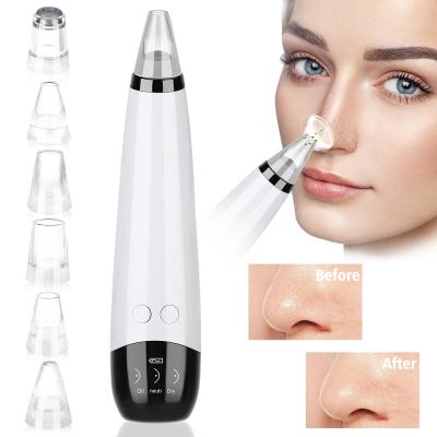 China 2021 Acne Treatment JOSUNN Factory Price Skin Care Nose Pore Cleansing Blackhead Acne Pimple Anthracnose Blackhead Remover Facial Vacuum for sale