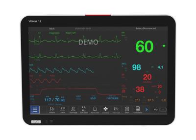 China Touch Screen 40-240bpm Ecg Spo2 And Nibp Monitor 12.5mm/S To 50mm/S Print Speed for sale