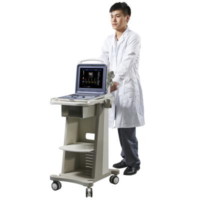 China Portable Abdomen Digital Full Color Doppler Ultrasound Machine for sale