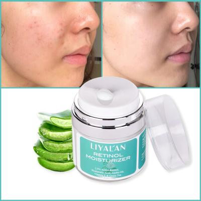 China Custom Natural OEM Vitamin A Cremas Blanqueadoras De Skin Revitalizer Organic Facial Cream Acne Anti Aging Whitening Face Cream for sale